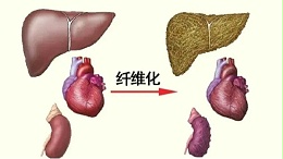 水蛭是临床常用的活血药物，能有效治疗器官纤维化