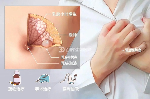 水蛭素、水蛭素胶囊、生殖妇科