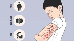 中医儿科杂志：水蛭治疗儿童过敏性紫癜，可缩短病程